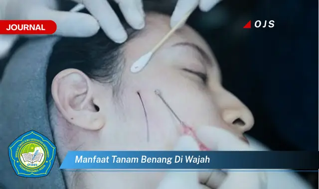 manfaat tanam benang di wajah