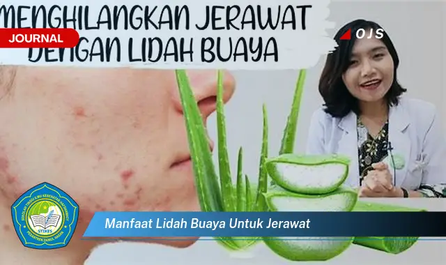 manfaat lidah buaya untuk jerawat