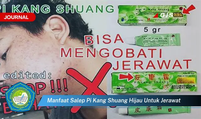 manfaat salep pi kang shuang hijau untuk jerawat manfaat salep pi kang shuang hijau untuk jerawat