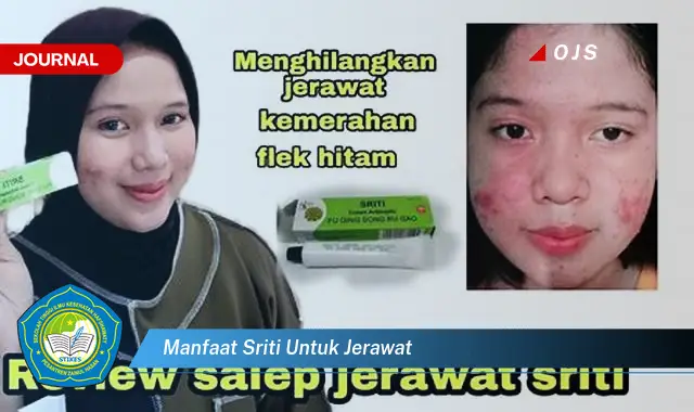 manfaat sriti untuk jerawat manfaat sriti untuk jerawat