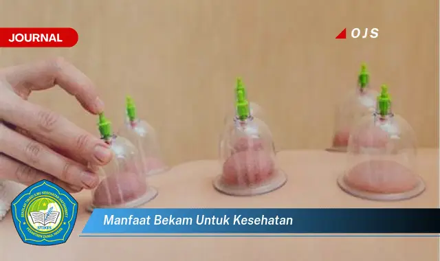 manfaat bekam untuk kesehatan manfaat bekam untuk kesehatan
