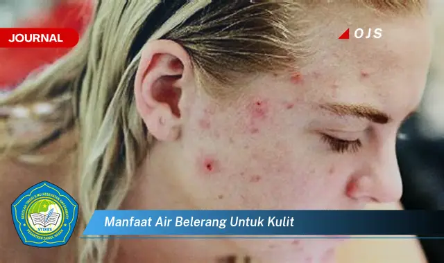 manfaat air belerang untuk kulit manfaat air belerang untuk kulit