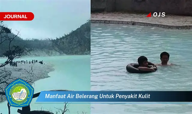 manfaat air belerang untuk penyakit kulit