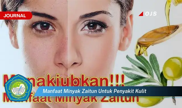 manfaat minyak zaitun untuk penyakit kulit manfaat minyak zaitun untuk penyakit kulit