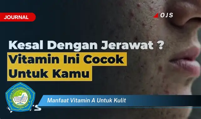 manfaat vitamin a untuk kulit manfaat vitamin a untuk kulit