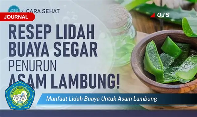 manfaat lidah buaya untuk asam lambung manfaat lidah buaya untuk asam lambung