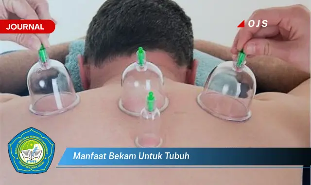 manfaat bekam untuk tubuh