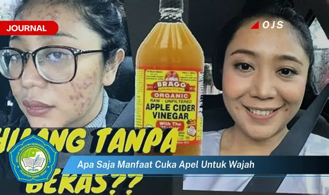 apa saja manfaat cuka apel untuk wajah