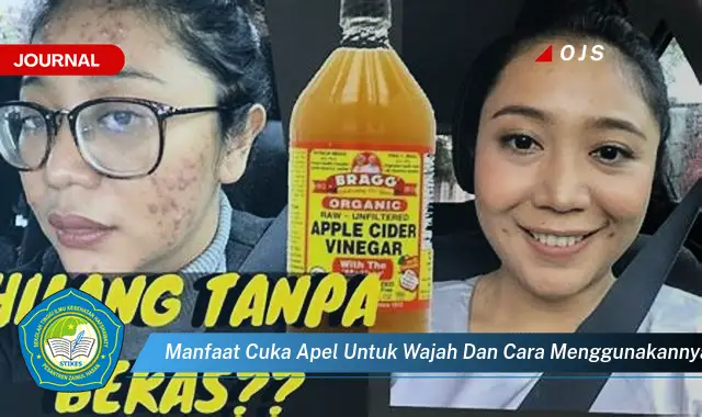 manfaat cuka apel untuk wajah dan cara menggunakannya