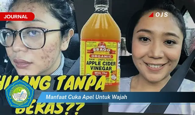 8 Manfaat Cuka Apel untuk Wajah yang Jarang Diketahui