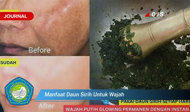 manfaat daun sirih untuk wajah