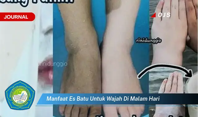 Ketahui 7 Manfaat Es Batu untuk Wajah Mulus di Malam Hari