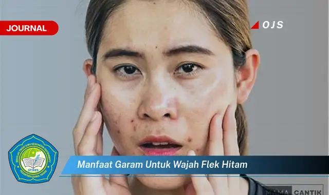 Ketahui 7 Manfaat Garam untuk Atasi Flek Hitam