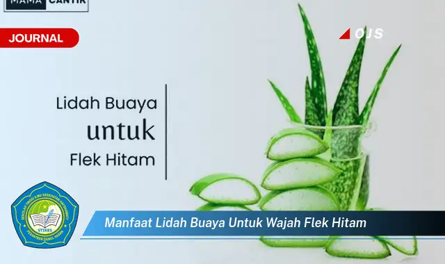 manfaat lidah buaya untuk wajah flek hitam manfaat lidah buaya untuk wajah flek hitam