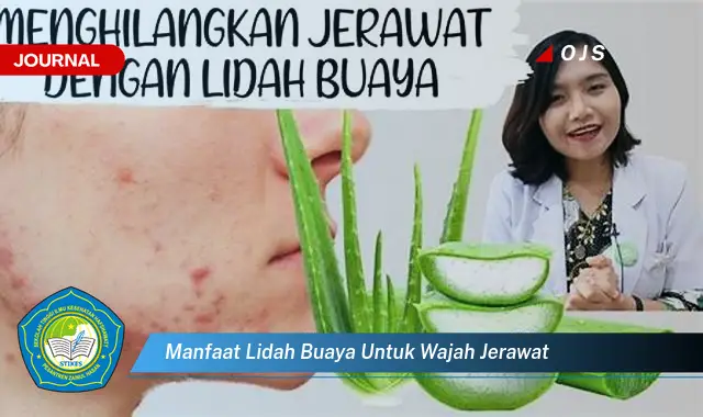 manfaat lidah buaya untuk wajah jerawat