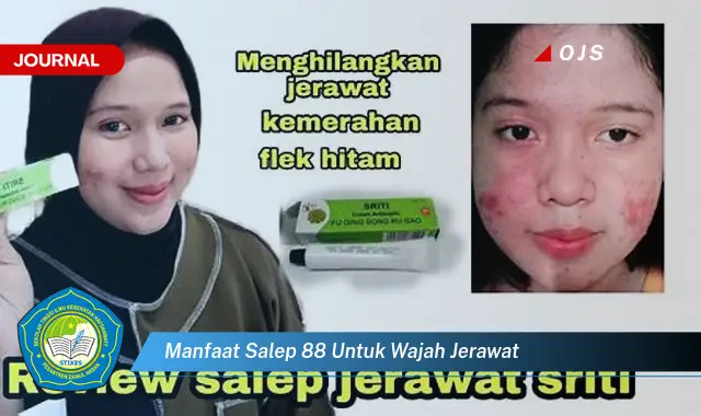 Ketahui 9 Manfaat Salep 88 untuk Wajah Berjerawat dan Cara Penggunaannya yang Tepat