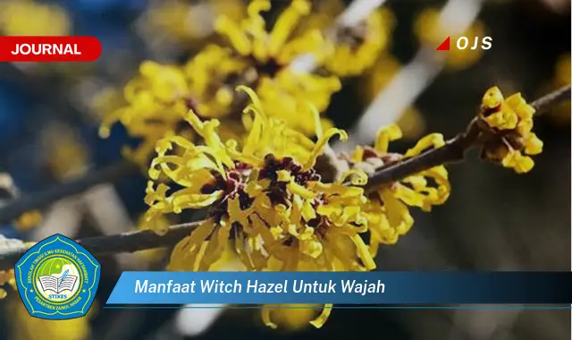 manfaat witch hazel untuk wajah